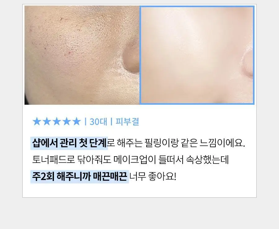 [피지제거/필링] 페이스팩토리 제트 필링기 상세페이지 16